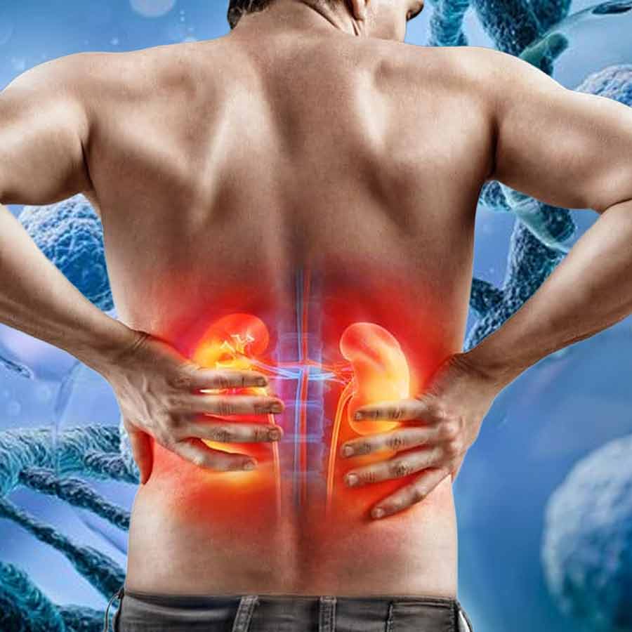 Researchers uncovered how fatty molecules called ceramides trigger acute kidney disease