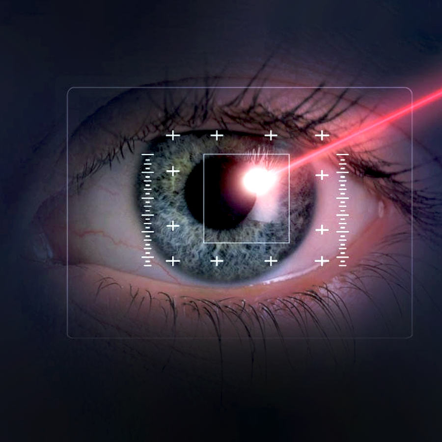 Diode Laser Transscleral  Cyclophotocoagulation therapy to treat glaucoma