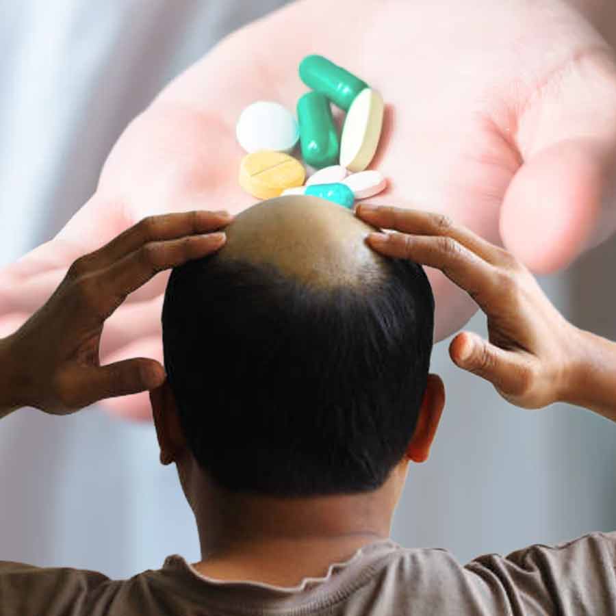 টাকে নতুন চুল গজাবে, কাজ করছে চেনা ওষুধই।