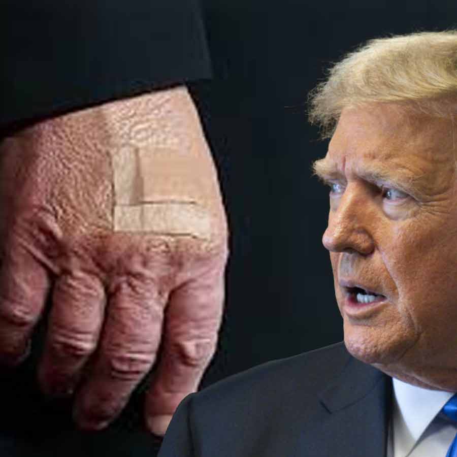 ট্রাম্পের ডান হাতের ব্যান্ডেজ নিয়ে গুঞ্জন শুরু।