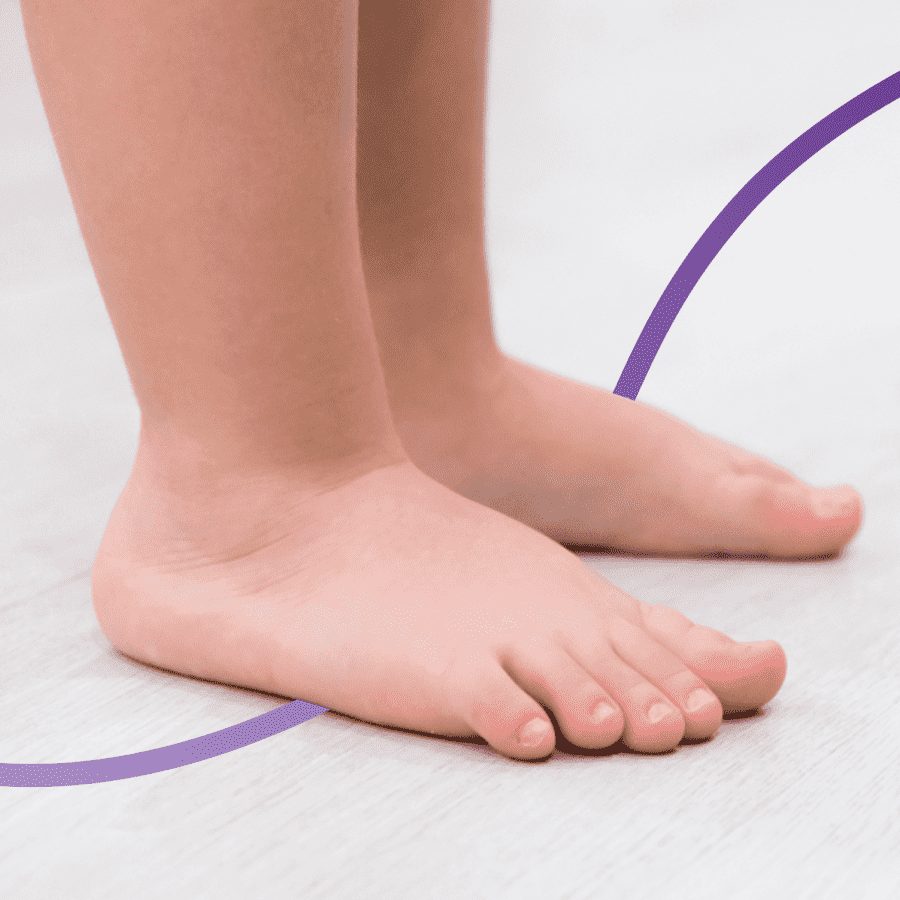things you should follow if you have flat feet problem dgtl
