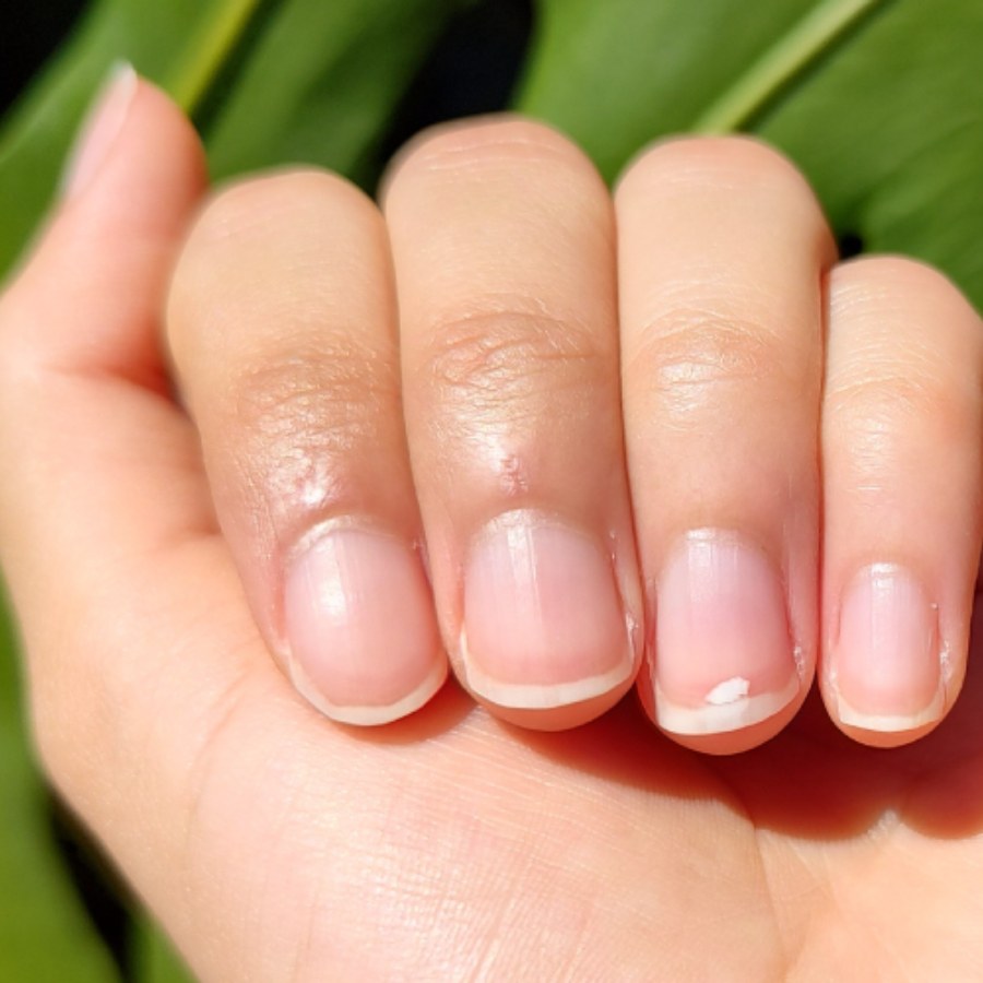 The changes in nails that signal health issues dgtl