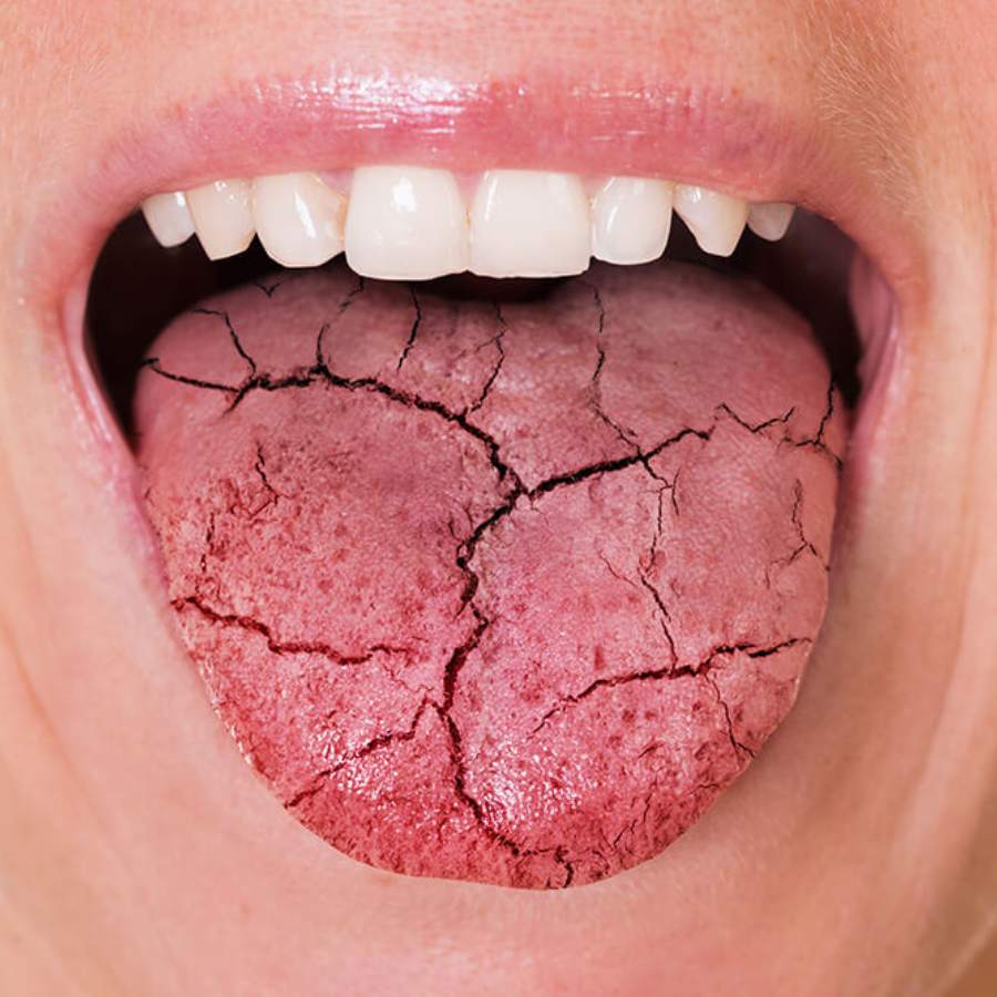 7 sign that tells your body is not getting enough water dgtl