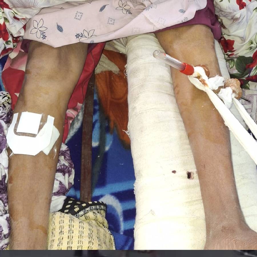 Murshidabad Medical College Row