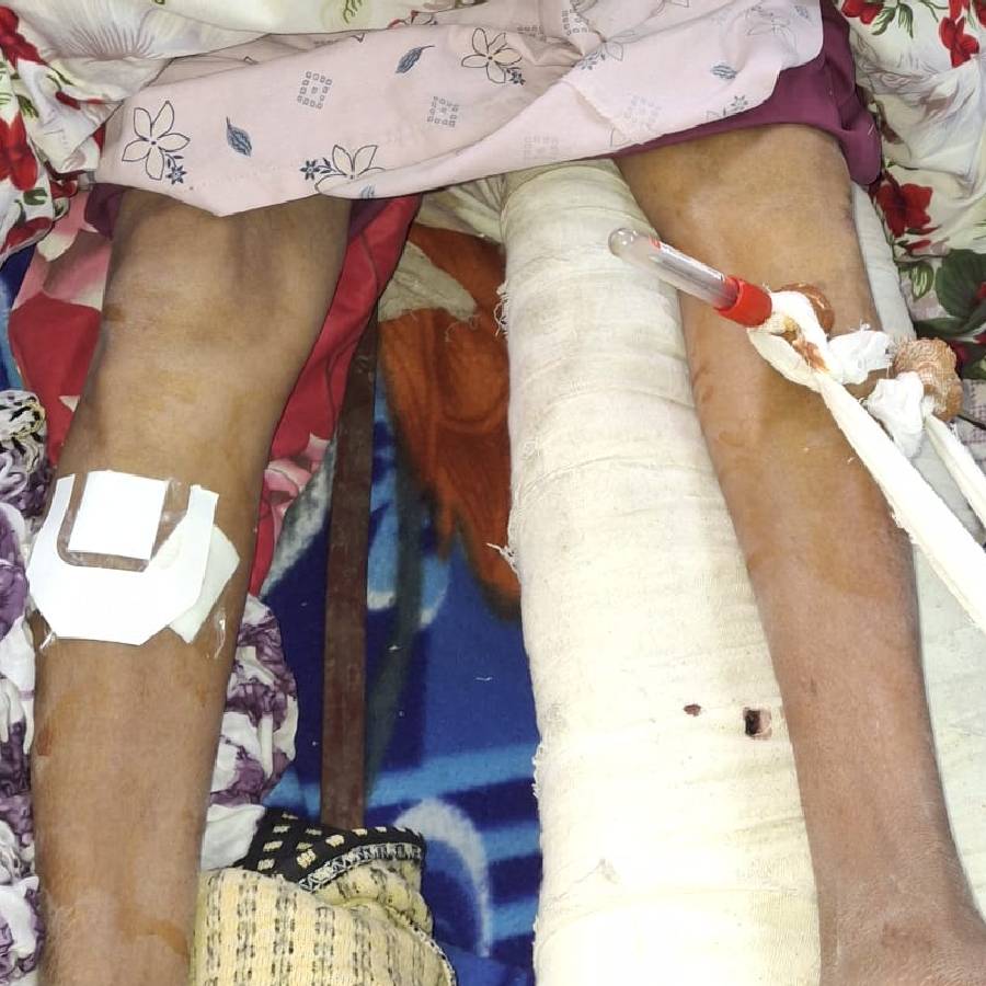 Murshidabad Medical College Row