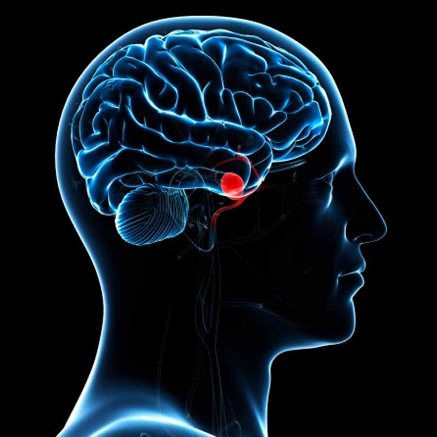 All need to know about actress Emilia Clarke and how she fights with brain aneurysm during shooting of Game of Thrones