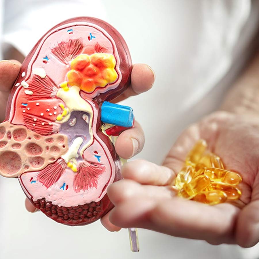 How vitamin D overdose can damage the kidneys