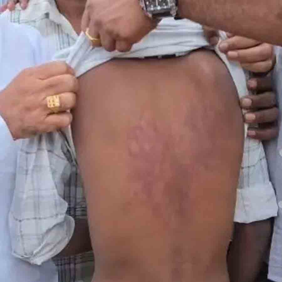 আক্রান্ত সেই ছাত্র। ছবি: সংগৃহীত।