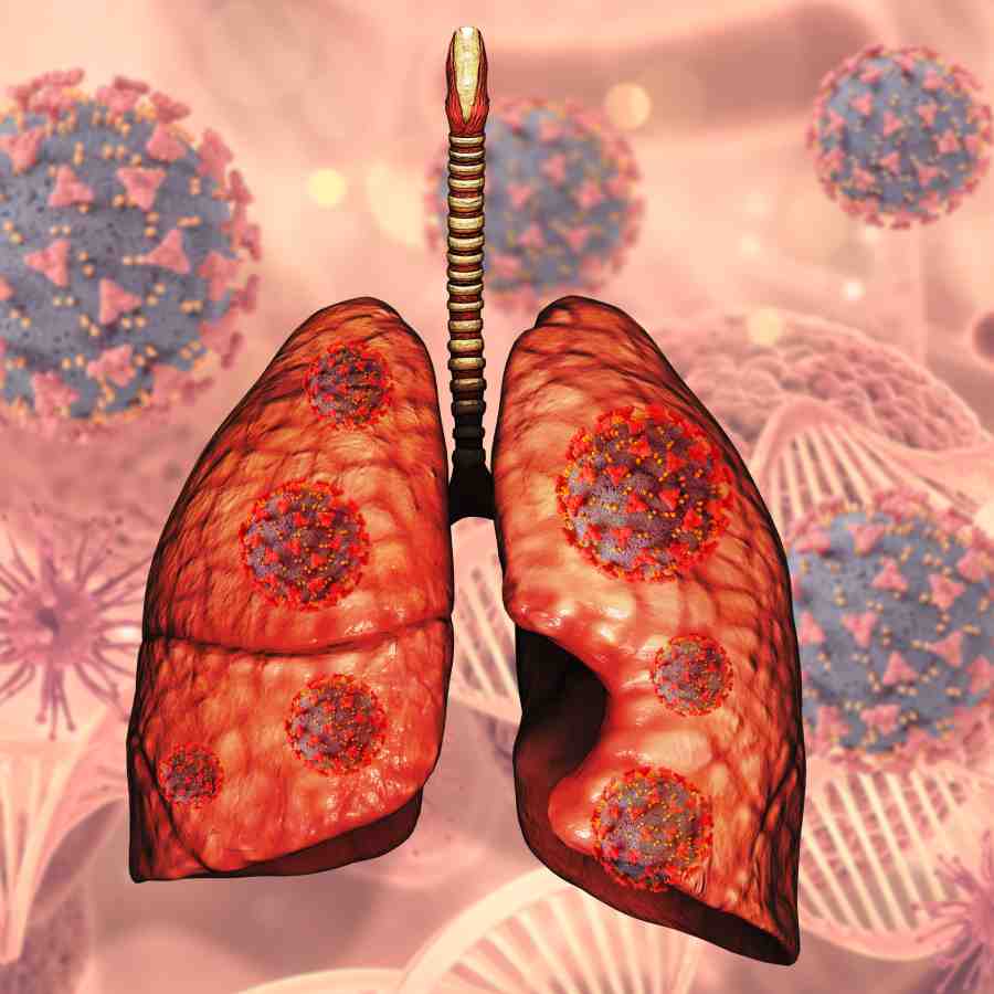 What is Pulmonary Hypertension disease, causes and Prevention tips