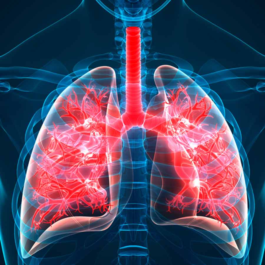 What is pulmonary fibrosis, causes, symptoms and treatment tips