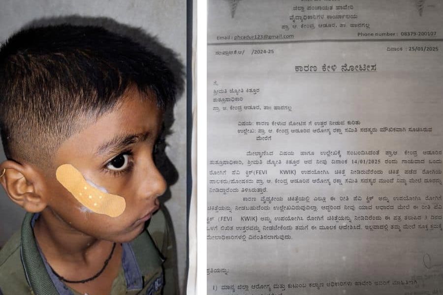 A government staff nurse in Karnataka was suspended for allegedly using strong adhesive instead of stitch dgtl