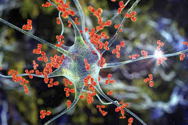 Diet & Nutrition Guidance for Guillain-Barré syndrome