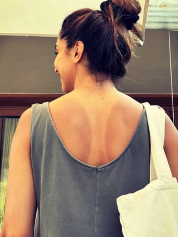 সৈকতে বেড়িয়ে এসে রোদে পোড়া ত্বকের ছবি দিয়েছিলেন দীপিকা পাড়ুকোনও। 