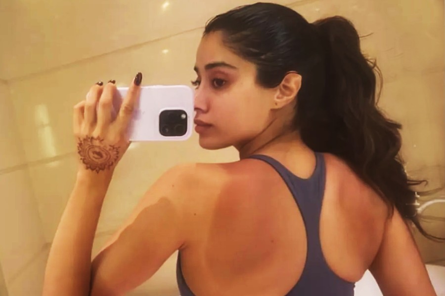 What you should not do if your skin got severely tanned in beach vacation dgtl