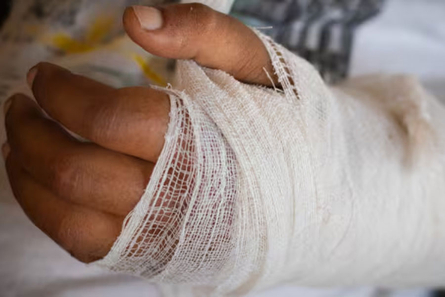 Class 11 student allegedly ragged and broke hand by seniors in Kerala school dgtl