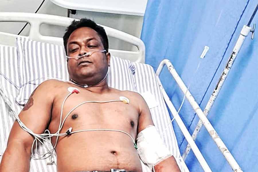 The injured police officer is giving different explanations about the bullet wound incident