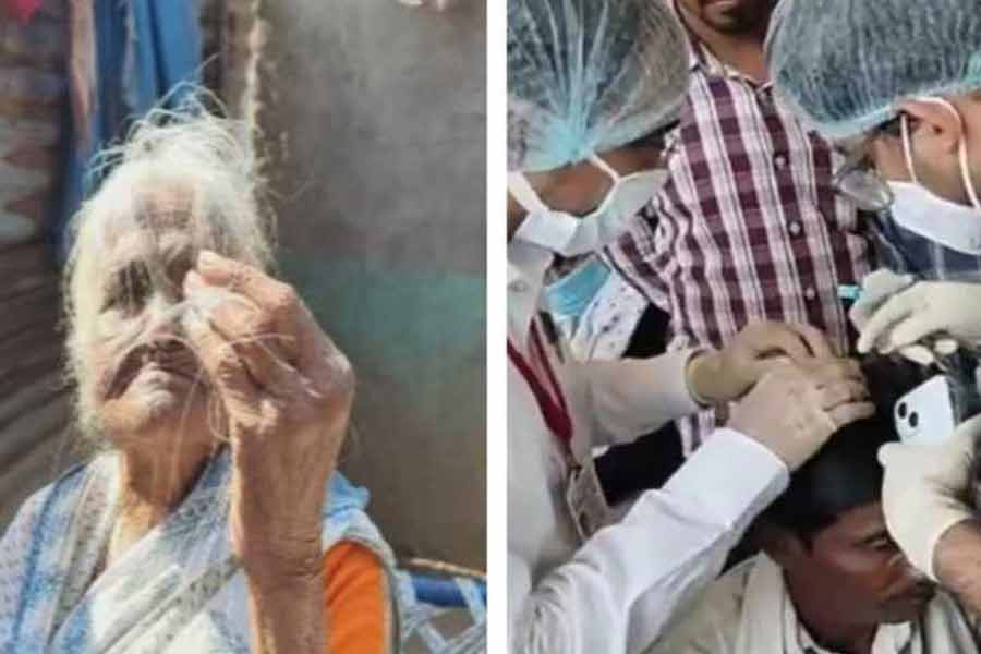 What is the mystery of baldness in Maharashtra Buldhana district dgtl