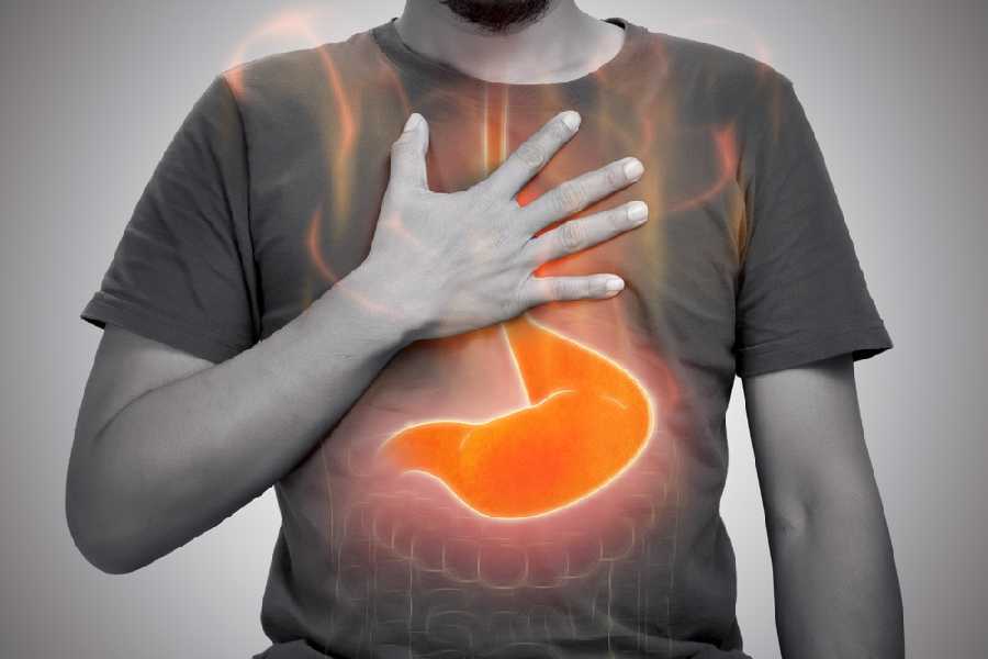 Five mistakes you should avoid before during and after a meal if you have gastric issues dgtl