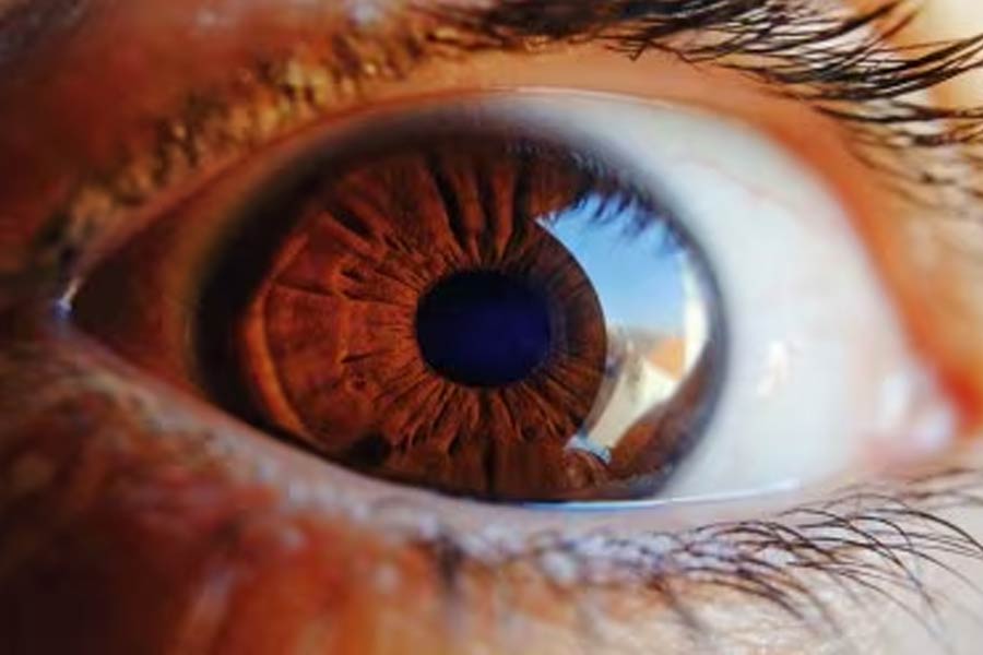 Eye Reveals risk of stroke, what are the symptoms