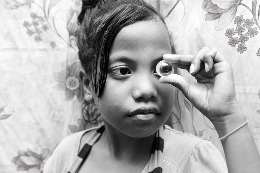 King of Pingelap Atoll Acts to Preserve Uninhabited Island as Rare Diseases Pass Through Generations