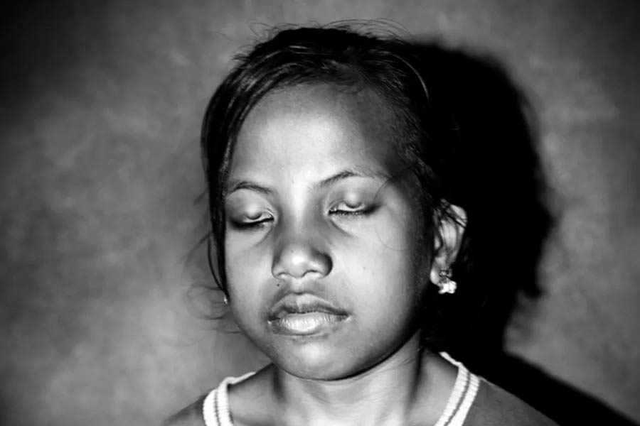 King of Pingelap Atoll Acts to Preserve Uninhabited Island as Rare Diseases Pass Through Generations