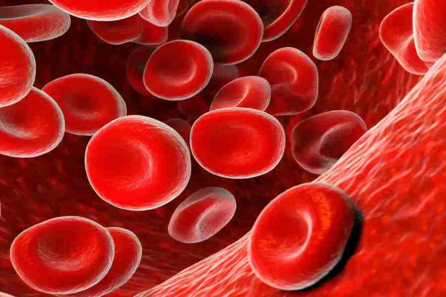 The majority of Anaemia cases in India are not because of iron deficiency, says study