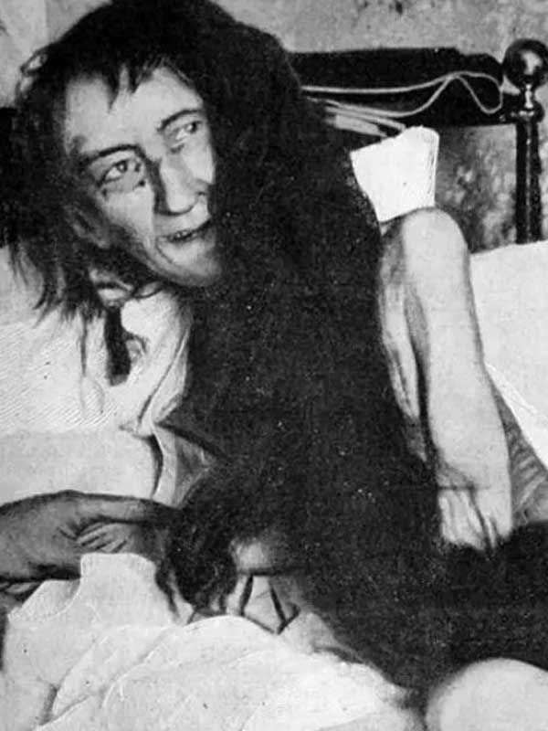 Blanche Monnier a young woman in France locked in a tiny room for 25 years by her own mother