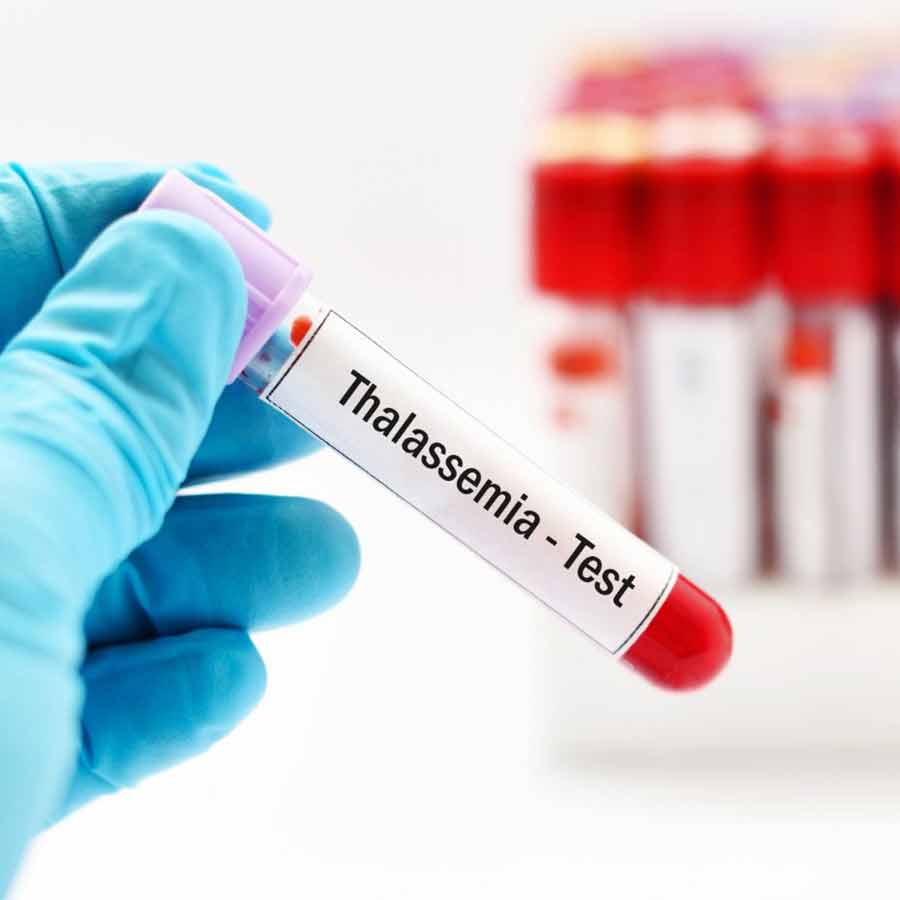Rules to be framed soon to make pre-marital thalassemia test mandatory: Minister dgtl