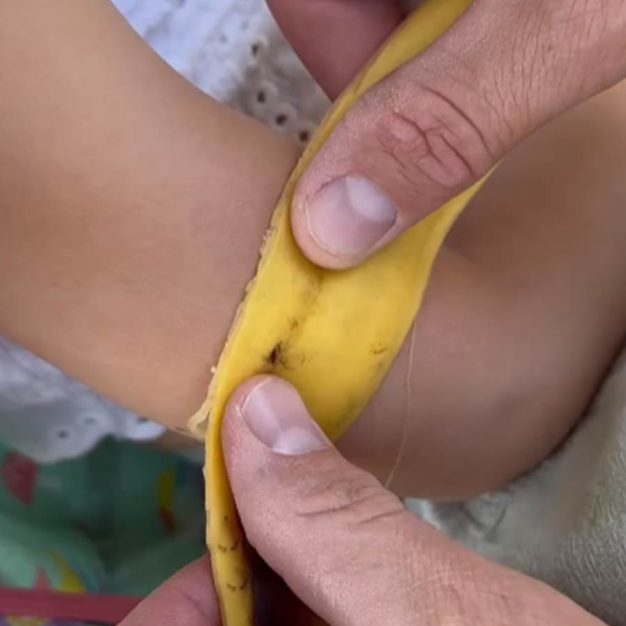 মশা কামড়ানোর জায়গাটিতে কলার খোলা ঘষে দেওয়া হচ্ছে, এমন অনেক রিল, ভিডিয়ো রয়েছে সমাজমাধ্যমে।