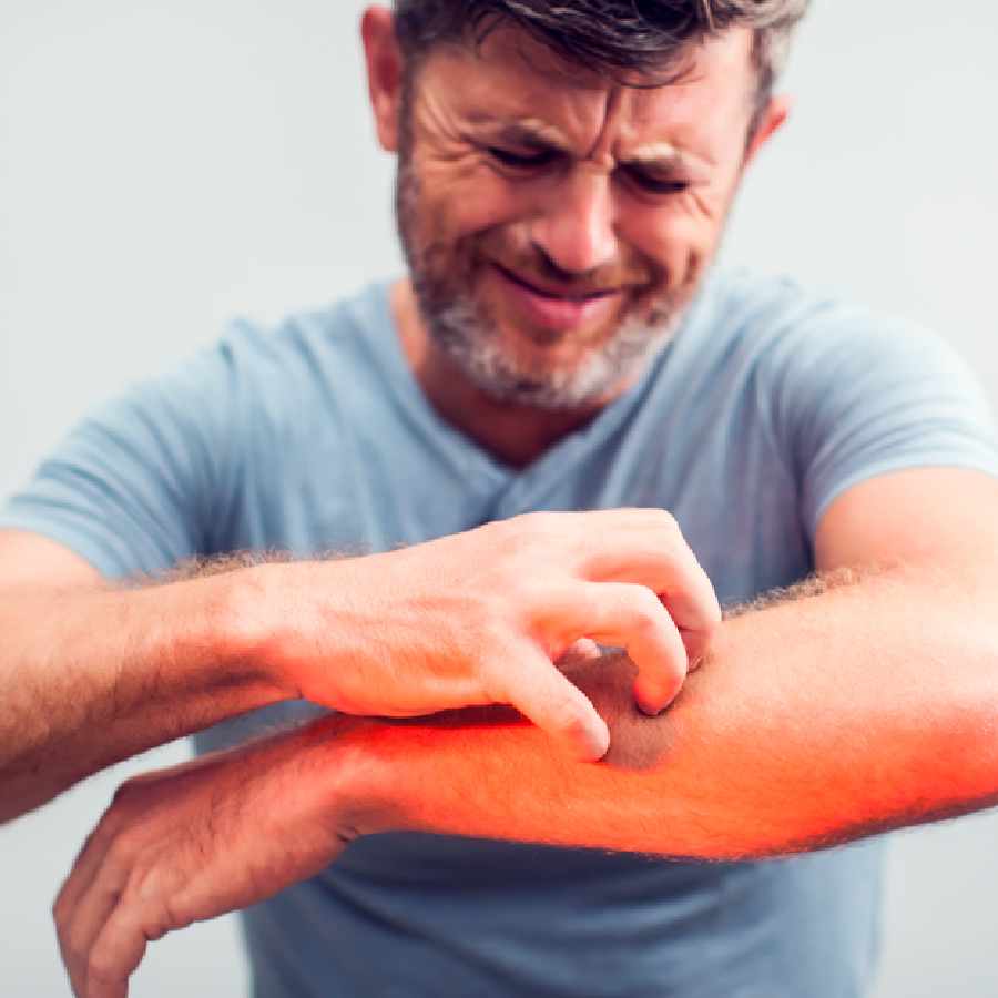 Important tips to prevent skin infection during monsoon season dgtl