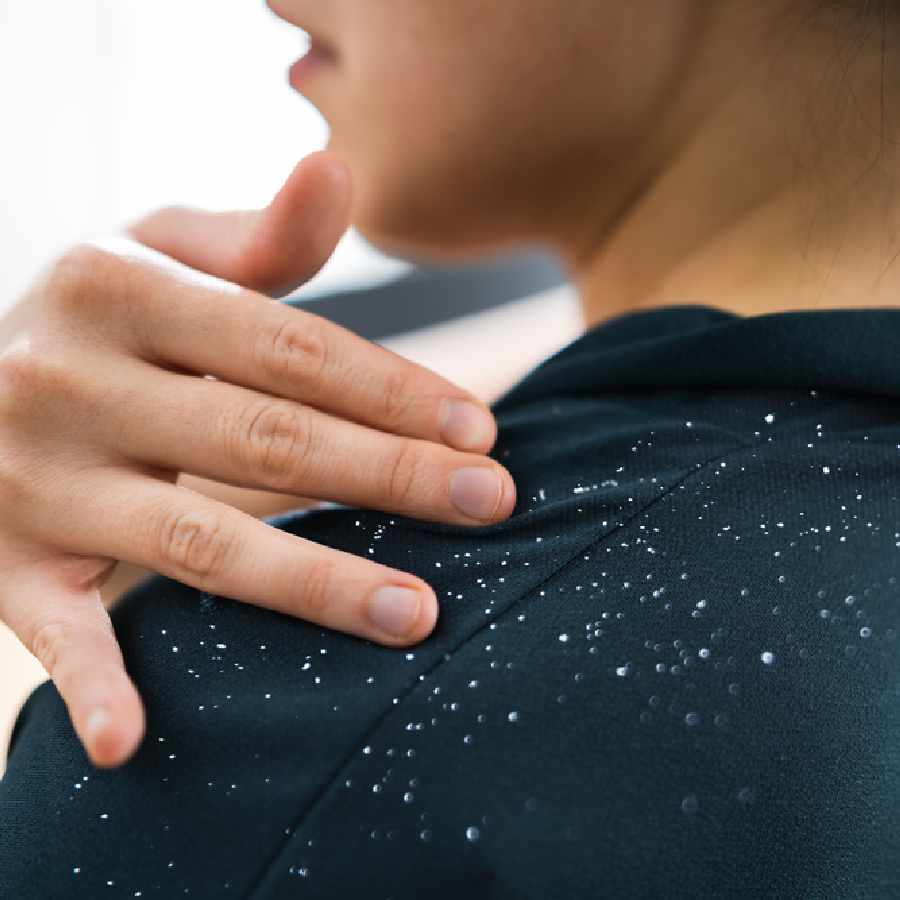 How to use curd to tackle hair problems dgtl