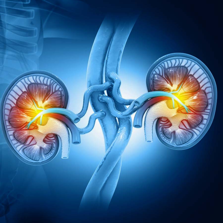 What is the difference between pain due to Kidney stones and the one because of back or gas