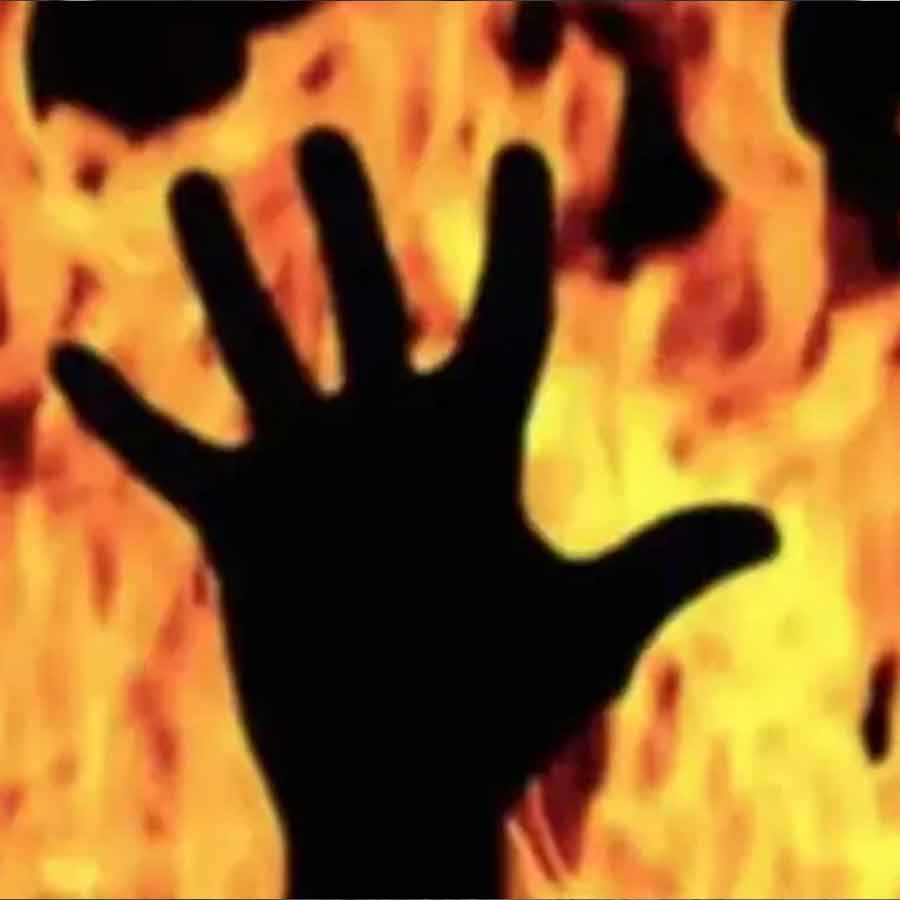 Odisha student with severe burn injury dies in Bhubaneswar AIIMS dgtl