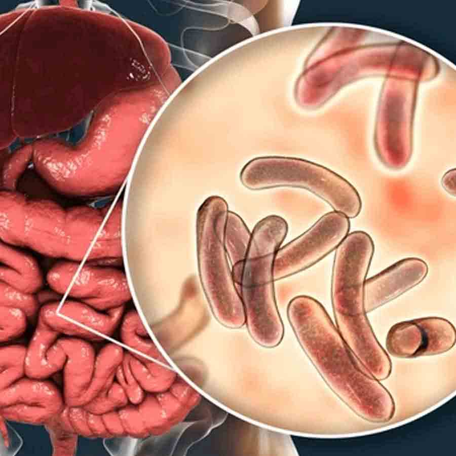 Picnic Garden youth contracted cholera is a proof that the disease could not be completely eliminated