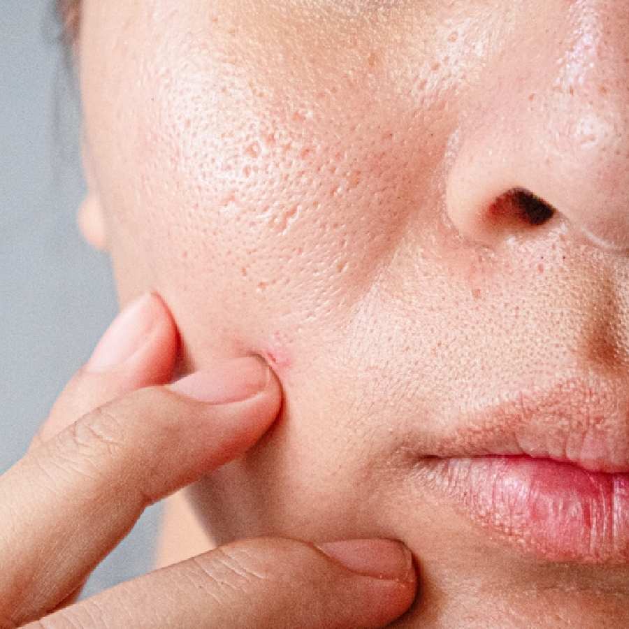 Tips you should keep in mind while applying makeup to cover large pores dgtl