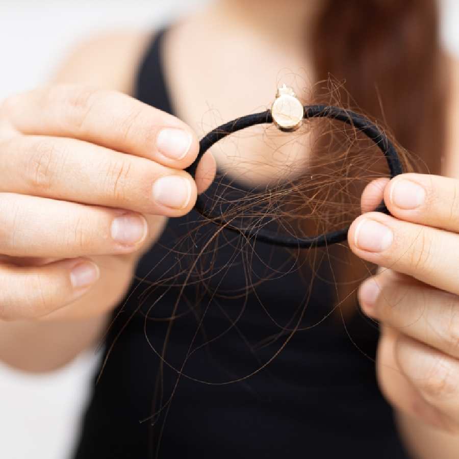 Five health conditions that cause hair fall dgtl