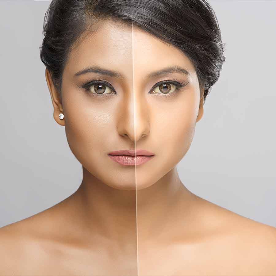 Why you should eat beta carotene rich food for glowing skin dgtl
