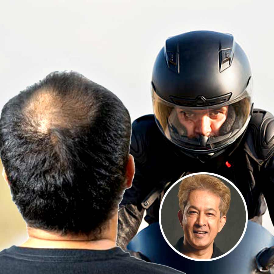 How to prevent hair loss after using helmet, tips from hair stylist Jawed habib dgtl