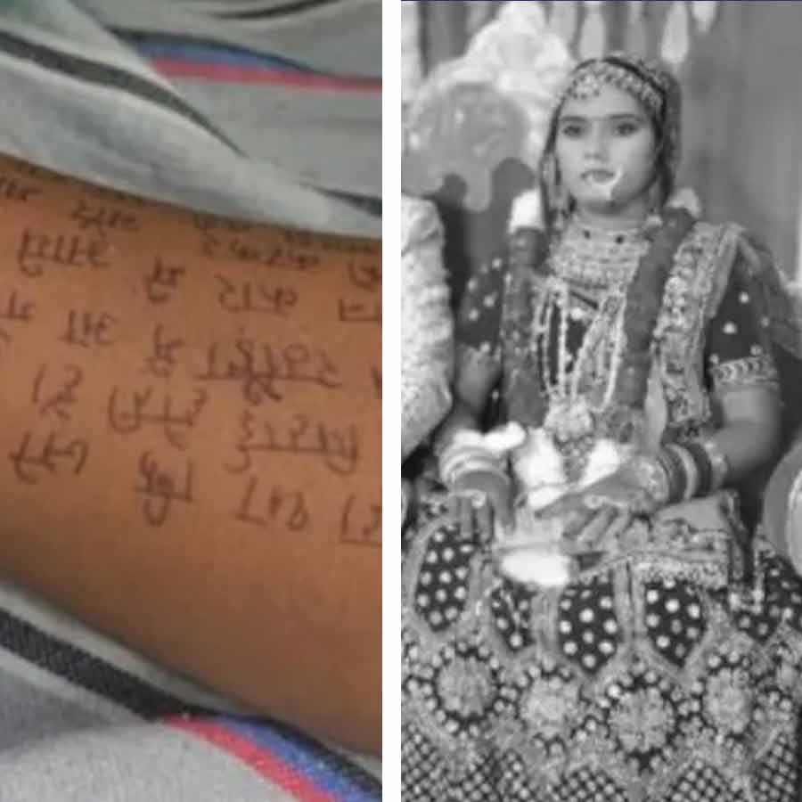 Up woman died alleging husband, in laws, writing letters on her hand, leg and stomach dgtl