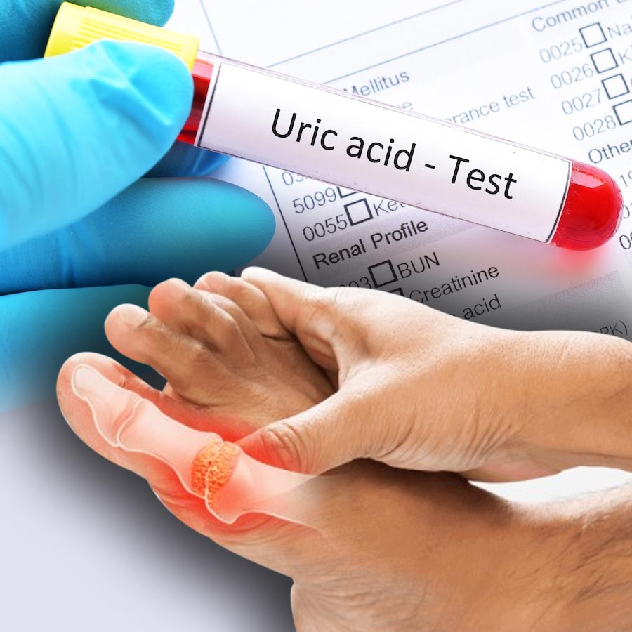 Five tips to bring down Uric Acid levels in one month dgtl