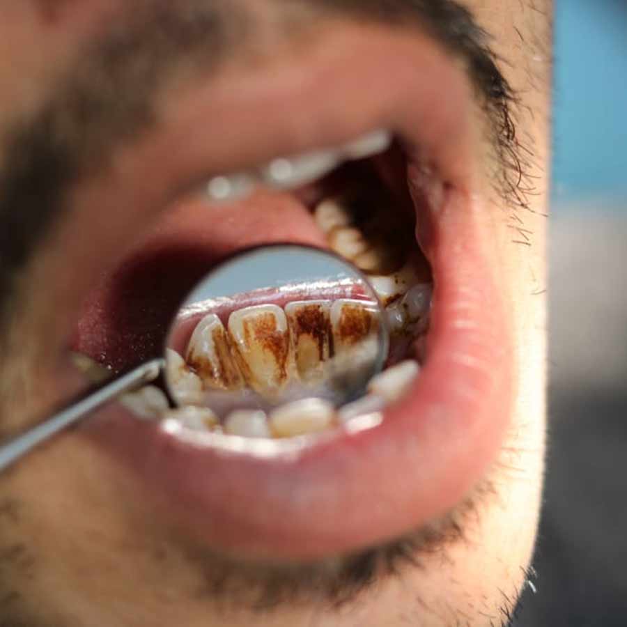 AIIMs new study says oral healthcare plays a significant role in improving health, including those linked to cancer