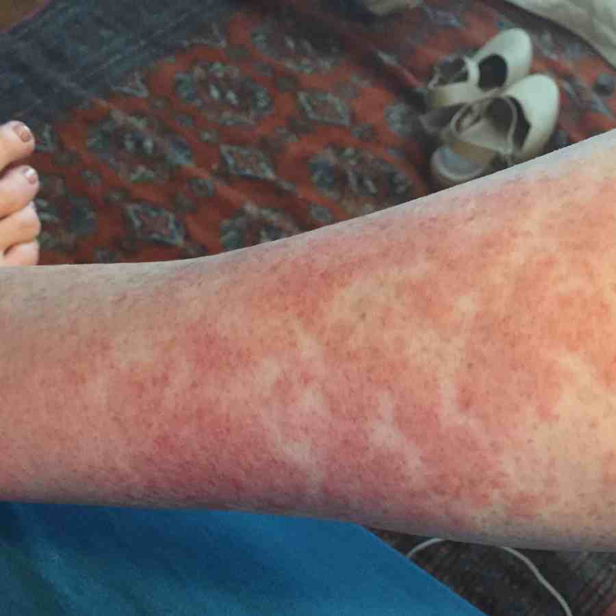 ডিজ়নি র‌্যাশ।