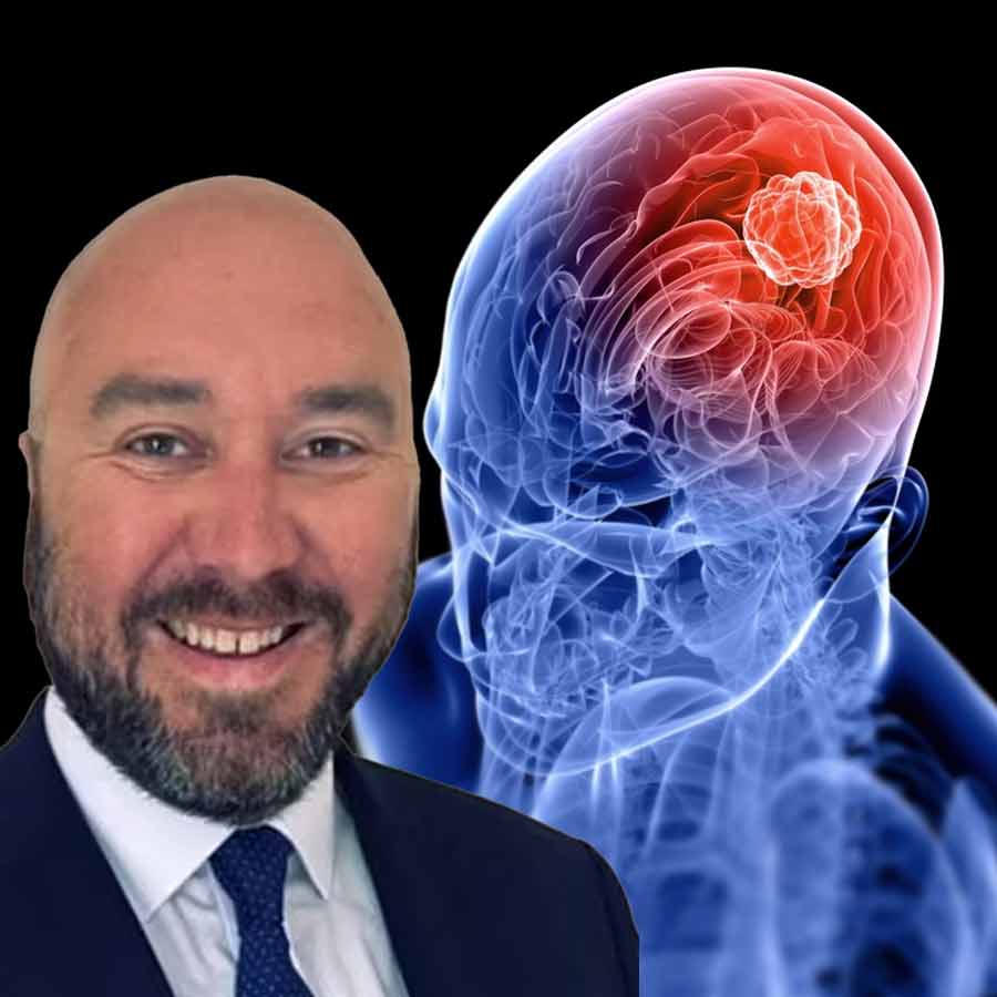 Ben Trotman was diagnosed with Glioblastoma is now cancer free after taking new Medicine