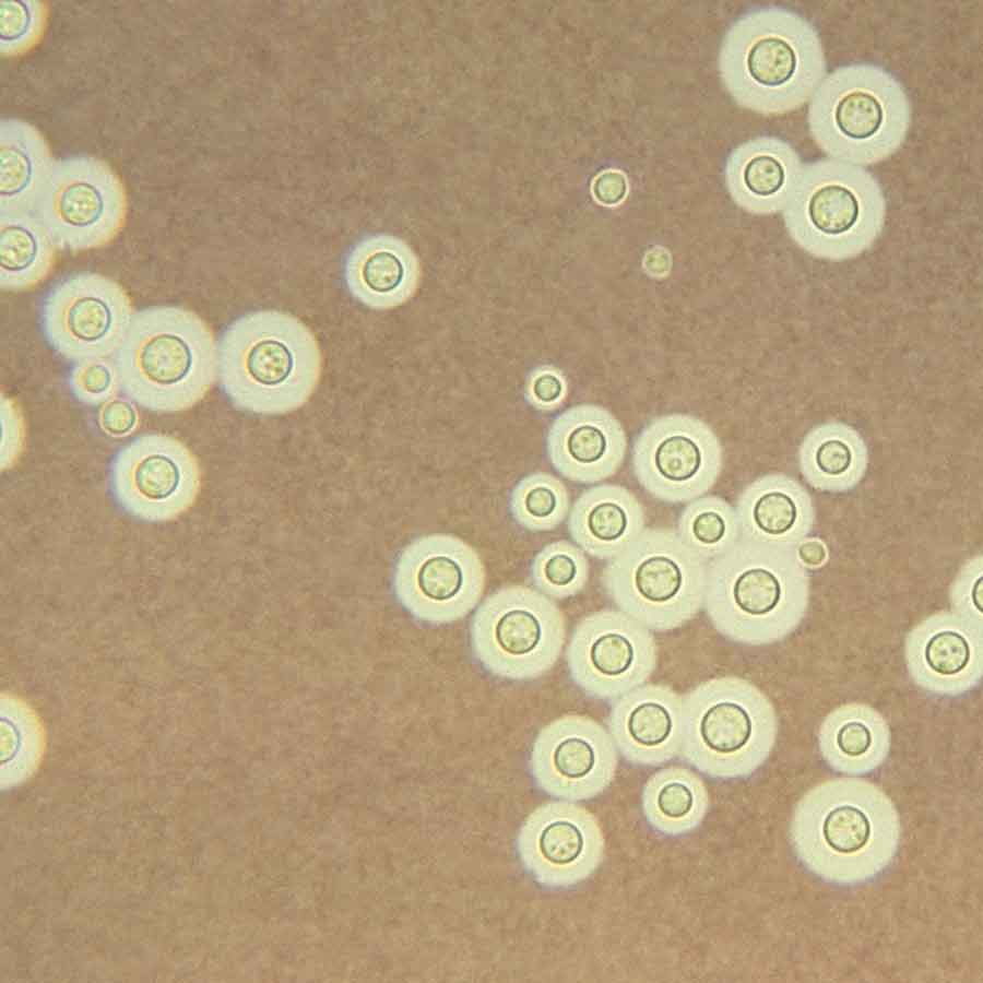 Mysterious fungus of Chernobyl