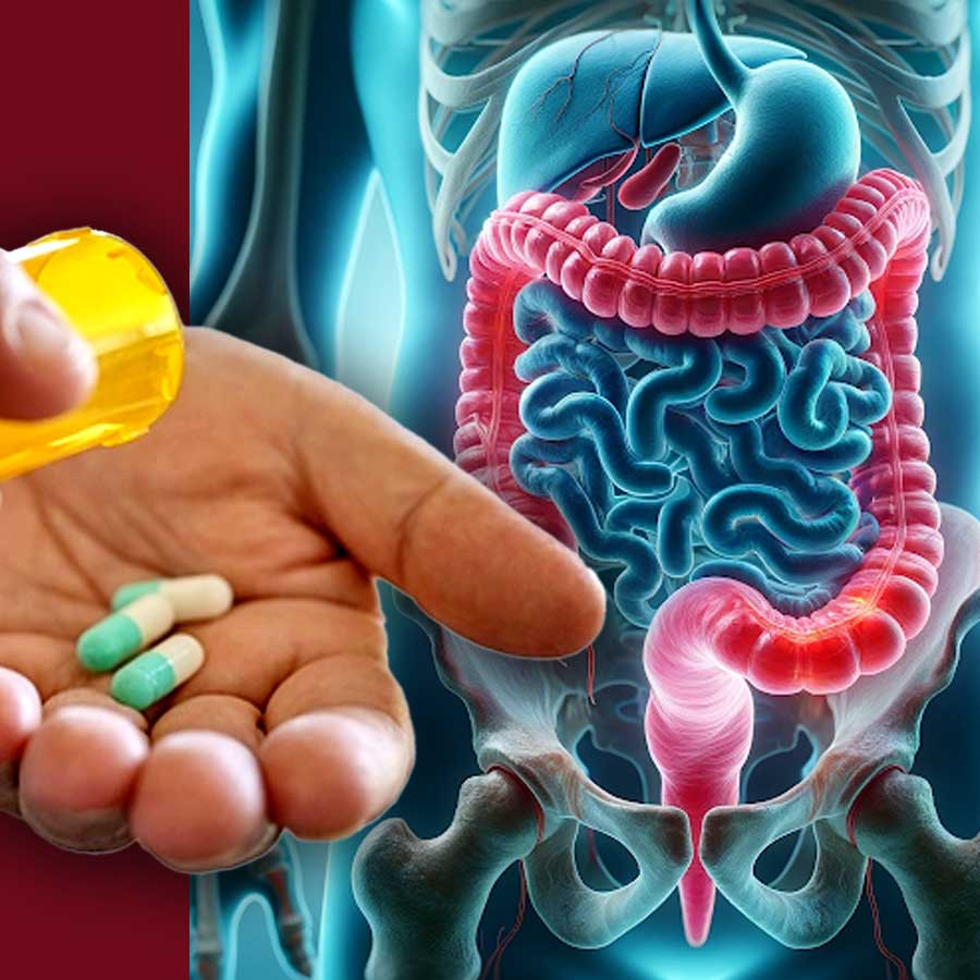 Tips to repair your gut after taking antibiotics, says doctor dgtl