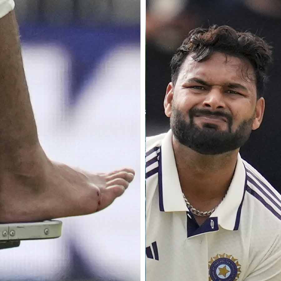 Rishabh Pant faces a painful metatarsal fracture, is this injury serious