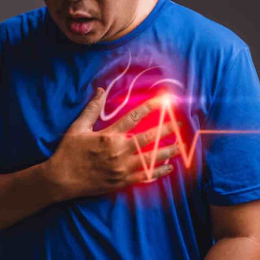 What is the basic difference between Heart Attack and Cardiac Arrest