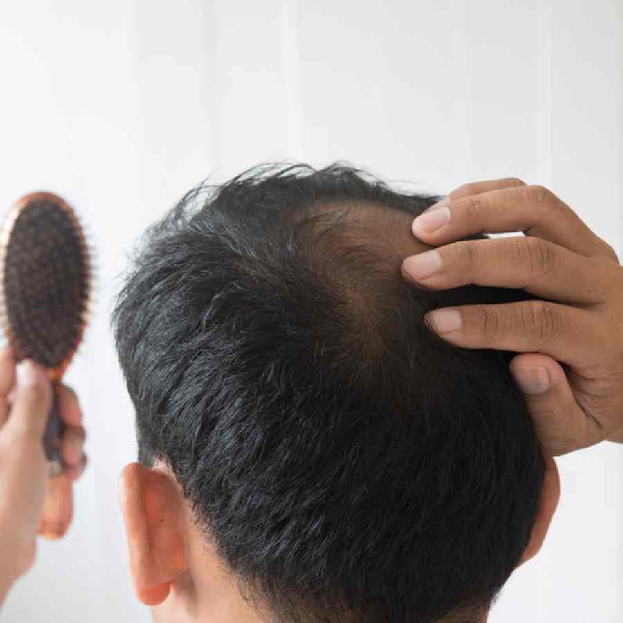 শুধু পেঁয়াজের রস মাখলে কিন্তু কাজ হবে না।