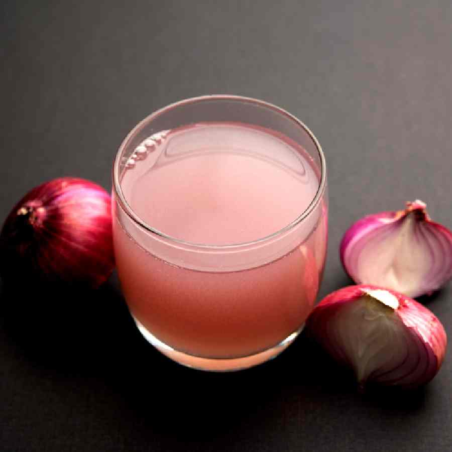 মাথার ত্বকে রক্ত চলাচল স্বাভাবিক রাখতে সাহায্য করে পেঁয়াজের রস।