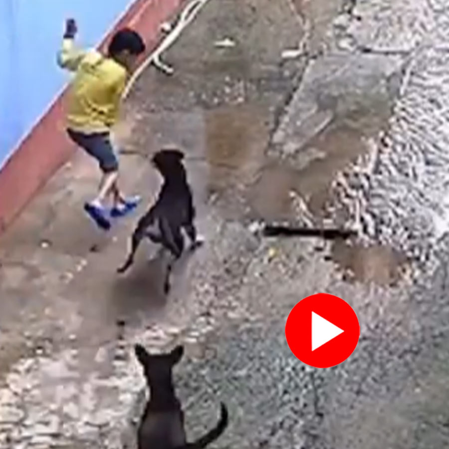 pack of stray dogs attack a little boy